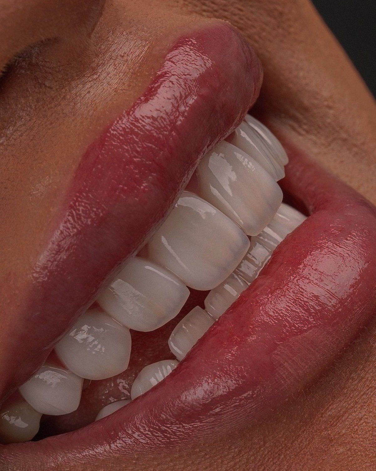 Отбеливание